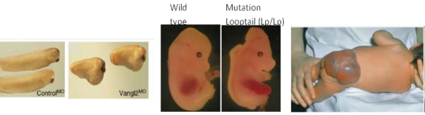 Figure 8 : Impact de la dérégulation de VANGL2 dans le développement des vertébrés ; de gauche à droite  :  embryon  de  xénope  (élimination  de  l’expression  de  Vangl2  par  un  morpholino-oligonucléotide),  souris  mutante  (mutation  Looptail  dans  