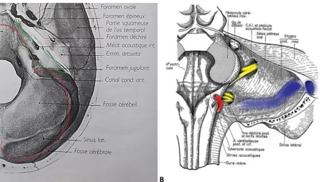 Figure  1: limite  de l’angle ponto-cérébelleux (APC). A : d’après  H. Rouvière et  A