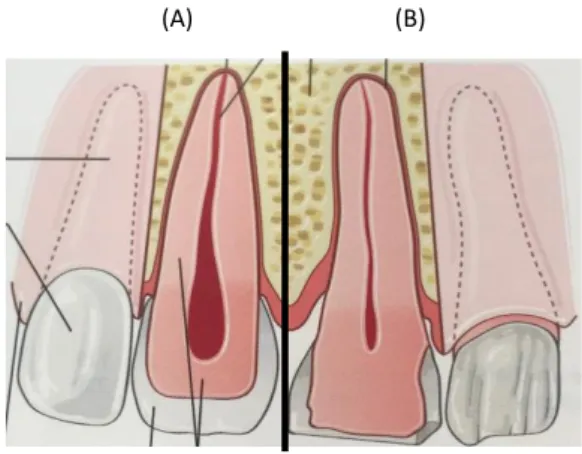 Figure 8 : Vue externe et vue en coupe de dents « jeunes » (A) et « âgées » (B) 