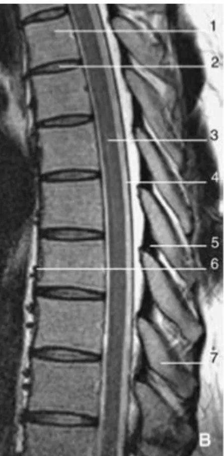 figure  8:  Imagerie  par  résonance  magnétique,  séquence  sagittale  médiane  pondérée  en  T2  du  rachis thoracique (d’après EMC) 
