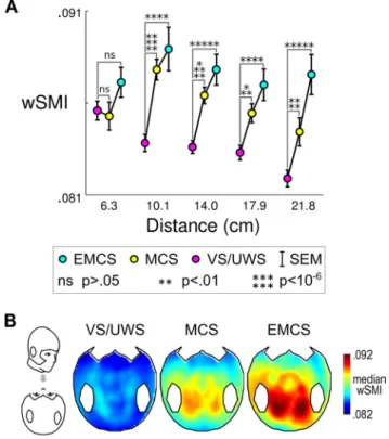 Fig. 4. In panel A, wSMI as a function of inter-channel distance. VS/UWS patients present lower information sharing compared to MCS and EMCS patients,  particu-larly over medium and long inter-channel distances (&gt;10 cm)