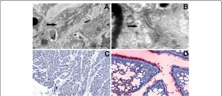 Fig. 3 Electron microscopy (a-b) and immunohistology (c-d) of heart tissue from recipient 2