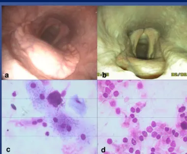 Fig. 2: Control endoscopy of horse 2, 24 hours (a) and 4 months (b)after surgery and microscopic appearance of its tracheal wash cytology before (c) and 4 months after surgery (d)