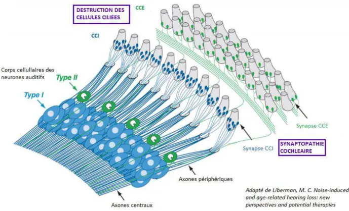 Figure 6 : Structures impliquées dans la surdité cachée combinant la destruction des cellules ciliées et la  synaptopathie cochléaire 
