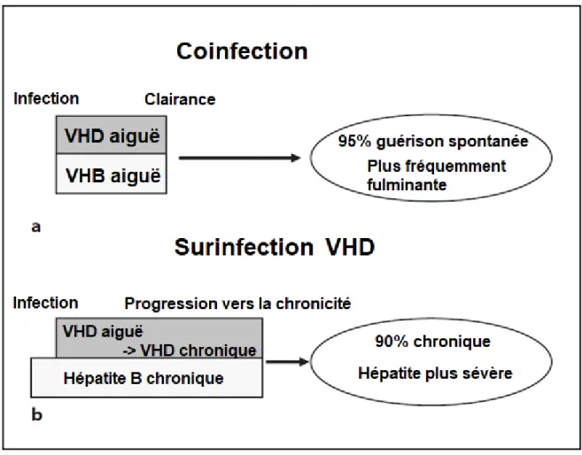 Figure 5. Comparaison schématique de l'évolution de la coinfection VHB / VHD (a) et  de la surinfection (b) d'un patient VHB avec VHD (24) 