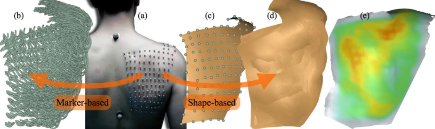 Figure 3 depicts the processing of three flexion-extension  periods  by  the  IMCP  algorithm