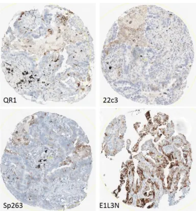 Figure 7 : Exemple de carottes discordantes entre E1L3N et les autres clon 