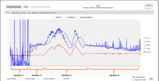 Figure 4 shows the airway pressure, flow, volume and calculated time-varying elas- elas-tance ( E drs ) curve for several breathing cycles before and after paralysis