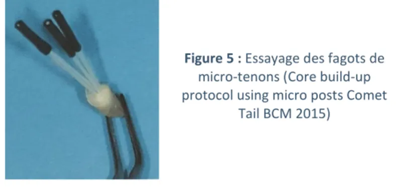 Figure 5 : Essayage des fagots de  micro-tenons (Core build-up  protocol using micro posts Comet 