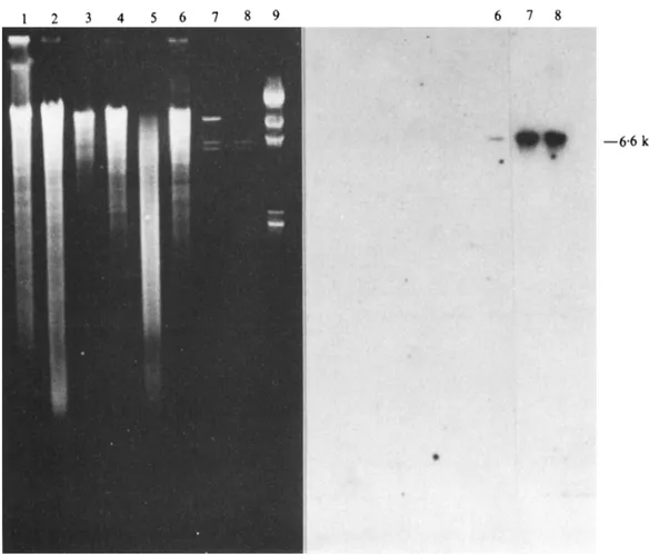 Fig.  2.  Hybridization experiments  using  32P-labelled pDML72  as probe  against  :  (i)  SphI-digested  DNAs  from Acrinomadura  R39 (lane l),  S