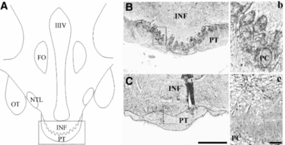 FIG. 3. Sexually dimorphic NKB innervation in the PT. A, Schematic drawing depicting the location of the human PT