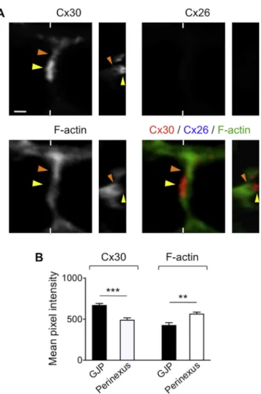 Fig. 2. Cochlear Cx30 exhibits dual co-localization patterns with the actin network.