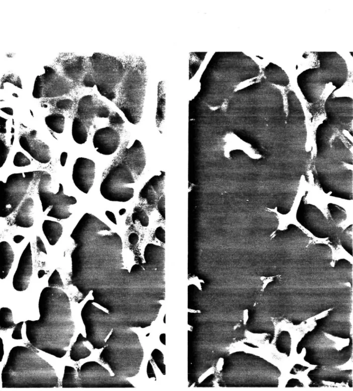 Figure 8 : Structure microscopique d'une vertèbre saine  (à  gauche) et d'une vertèbre  ostéoporotigue  (à  droite)