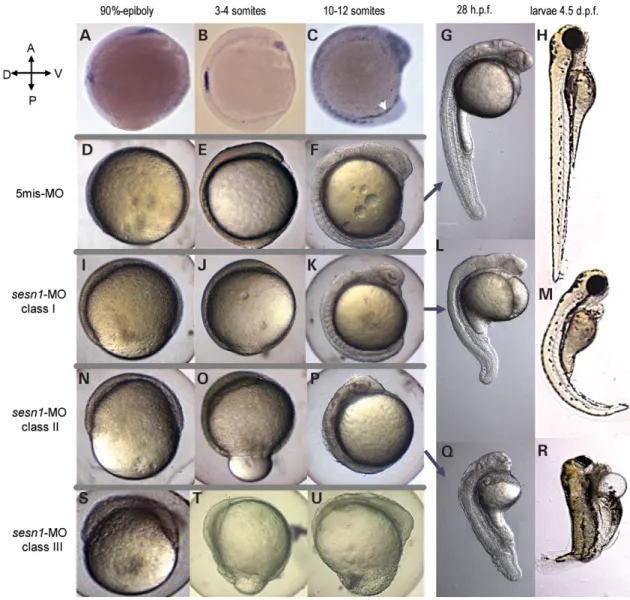 Figure 2. Expression of sesn1 in wild type embryos (A– C) and effect of sesn1-MO knockdown on zebrafish development (D– R)