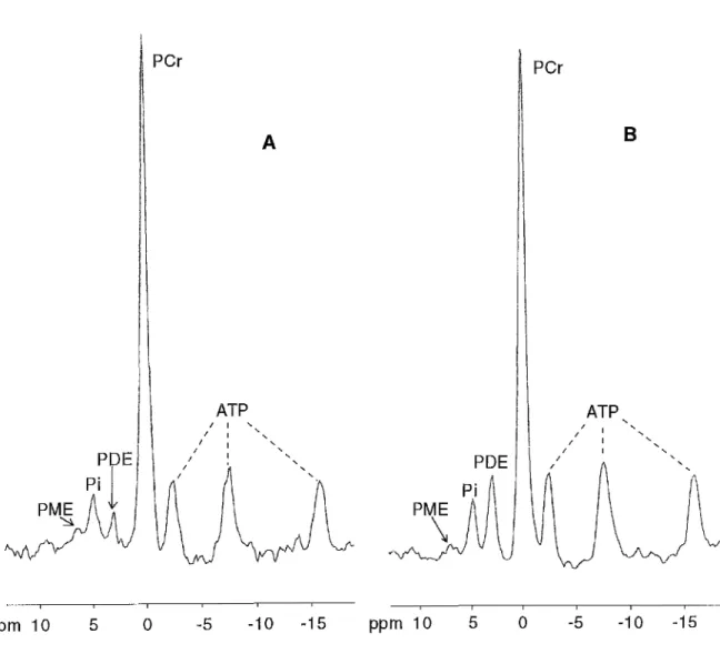 Figure I.6. Spectres RMN  31p  in vivo  d'un patient HMN (A) et d'un patient HMS  (B)