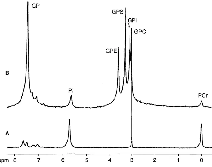 Figure IV.5. Spectre d'un extrait perchlorique de muscle HMS avant (A) et après (B)  addition des différentes solutions standards