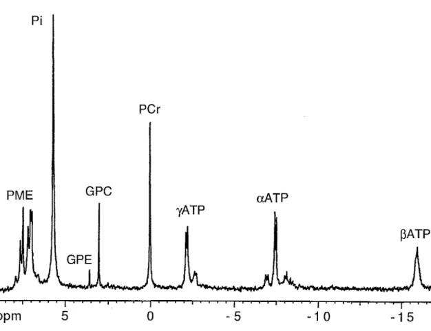 Figure IV.6. Spectre RMN  31p  in vitro d'un extrait musculaire de sujet HMN. 