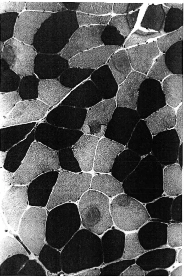 Figure IV.9. Aspect en microscopie photonique d'une coupe de fibres musculaires de sujet  HMS après action del' ATPase myofibrillaire et contre coloration par le bleu de toluidine