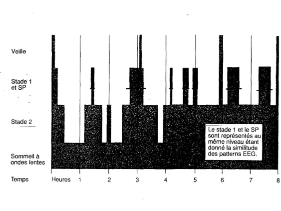 Diagramme montrant la distribution des stades et des états de sommeil  chez le sujet jeune de 30 ans selon BILLIARD M