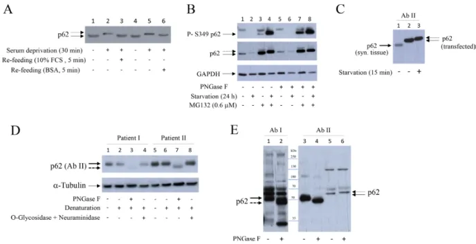 Figure 7: Bovine serum albumin reverses higher MW of p62 to usual MW.  PNGase F transforms p62 to de-glycosylation-like  form with lower MW in human synovial tissue extracts
