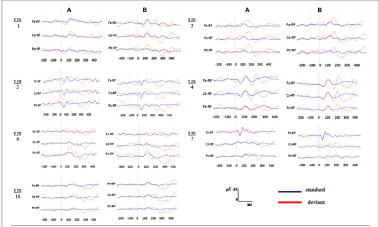 FIGURE 2 | Individuals P300 waveforms in the patients with locked-in syndrome (LIS) at each task condition