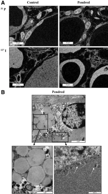 FIG. 2. A, Ultrastructural distribution of 31 phosphorus ( 31 P) and