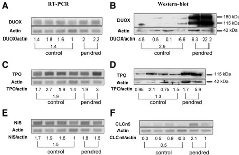 FIG. 4. Duoxs, TPO, NIS, and CLCN5 mRNA expression and Duox, TPO protein expression.