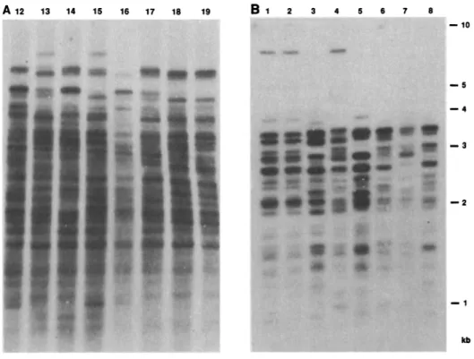 Fig. 4. Hypervariable polymorphic patterns detected in human (A) and bovine (B) DNA by hybridization to a tandem repeat present in M13 (15)