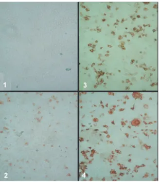 Figure 1. Transient expression of BVDV E2 glycoproteins in Cos7 cells. Cos7 cells were transfected with the following plasmid DNA and stained with polyspecific anti-BVDV calf antiserum DSV229/2 by the IPMA method