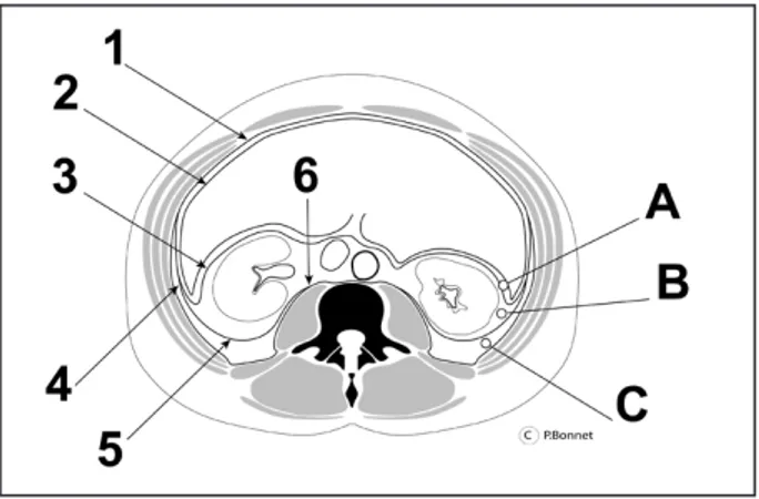 Figure 2. Coupe transversale du tronc au niveau lombaire. 1 = fascia trans- trans-versalis,  2  =  péritoine  pariétal,  3  :  feuillet  du  antérieur  du  fascia  rénal  de  Gerota (fascia de Toldt), 4 = fascia latéro-conal, 5 = fascia rénal postérieur  (