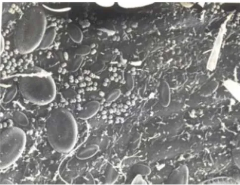 Fig. 2 : Biofilm présent sur des feuilles de posidonies où on peut reconnaître divers types de bactéries et de  diatomées (Dauby &amp; Poulicek, 1995)
