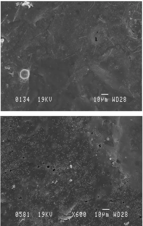 Fig. 3 : en haut : film bactérien mature en expansion sur une feuille artificielle; en bas : film bactérien constitué  de bacilles, en pleine expansion, sur une feuille artificielle (Grossissement: 600x)