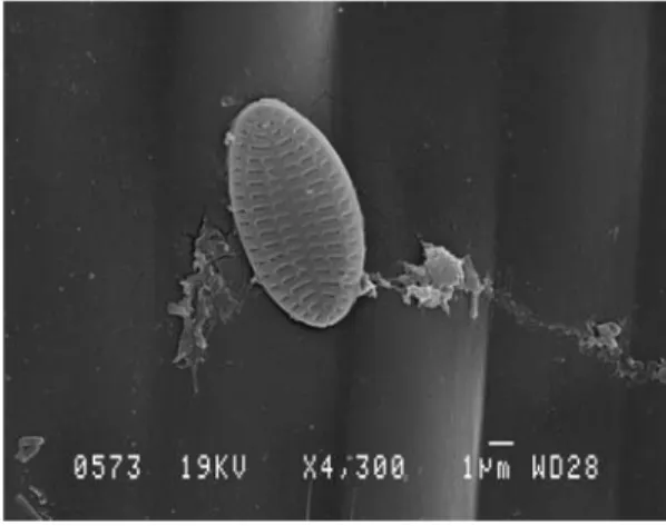 Fig. 4 : Diatomée du genre Cocconeis sur une feuille de Posidonia oceanica (Grossissemnt : 4300x)