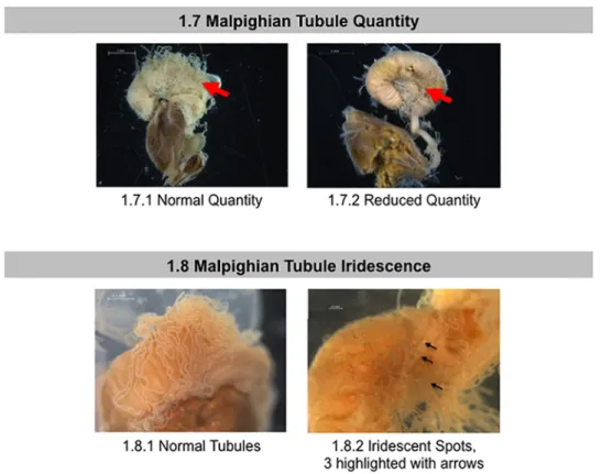 Fig 4. Normal and abnormal observed Malpighian tubules of healthy bees and bees taken from CCD colonies