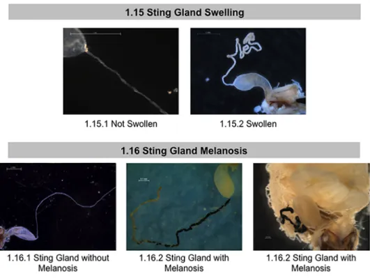 Fig 8. Normal and abnormal observed tissues in the sting glands of healthy bees and bees taken from CCD colonies