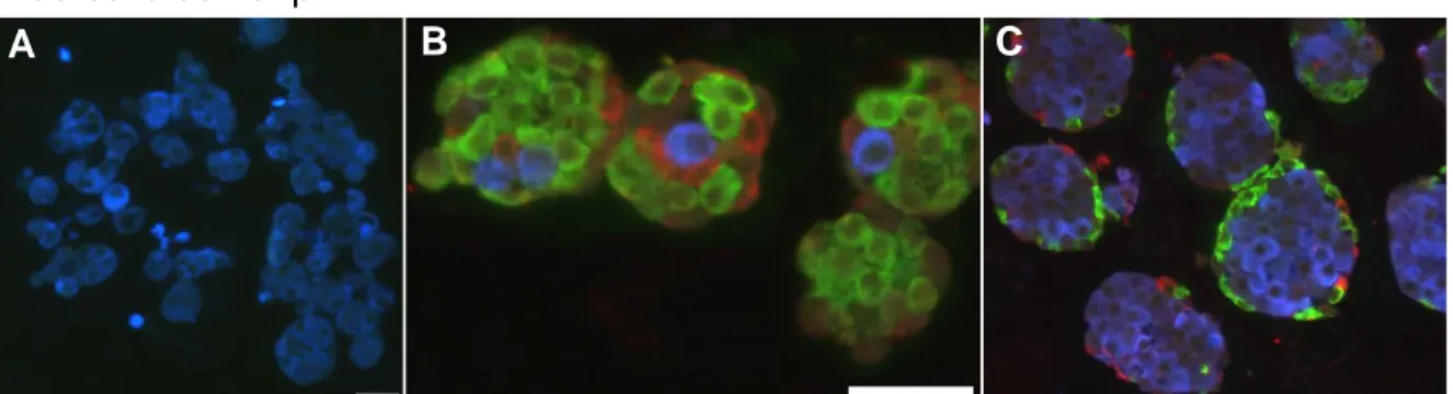 Figure 3. Photos en microscopie à fluorescence des pseudo-îlots β / nonβ et  mix β-nonβ 