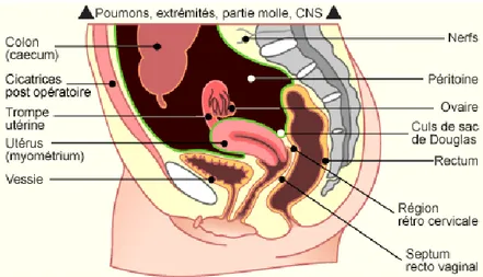 Figure 11 : Localisation des lésions d’endométriose(24)  