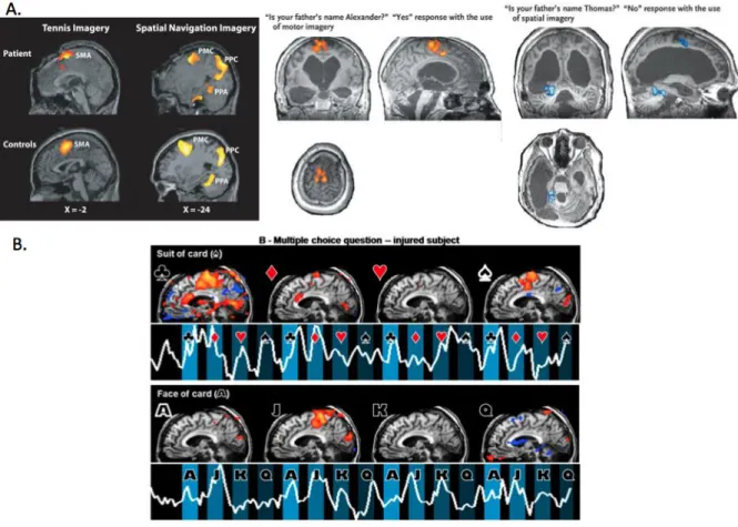 Figure 4. Assessment of command following and communication using functional  neuroimaging