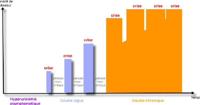 Figure 12 : Evolution de la goutte sans prise en charge thérapeutique 