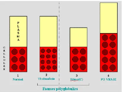 Figure 6 : Représentation schématique du VGT. (10) 