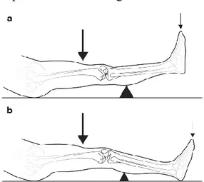 Figure 12 : Test du Levier tiré de Lelli et al.  The “Lever Sign”: a new clinical test for the diagnosis of anterior  cruciate ligament rupture 