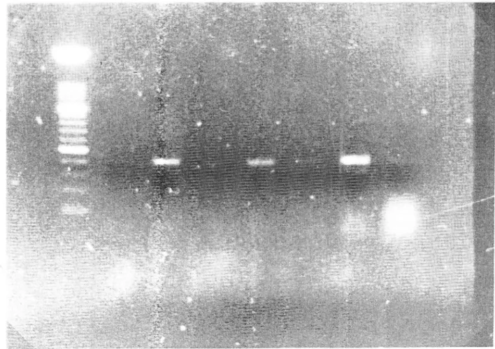 Figure  I  -  Agarose gel  s1sçuophoretic  anall  srs  oj  Jilanrrt  one tube  RT-PCR  amplification prôducts  obta-ined  with  pnmeriASpVlR-ASPV2F  from  dl RN{  preparations.of_app_Je  trees LpOSO  (bark:  l)