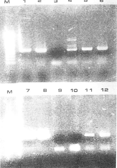 Figure  2  -  Agarcse  gel r-1,'itrophor.jl.  Tul:Jqs_  glTltanr\r  one  tube  RT-PÇI  *Ottf,ication pifiàucts  obtJined  çith  p,rrrrers  ASGV4F-ASGV4R from  crude extracts  of  healthy  (3,9.)  or