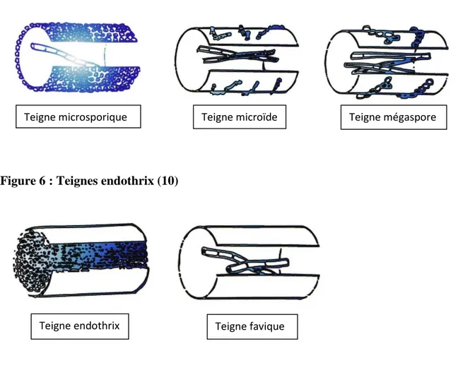 Figure 5 : Teignes ecto-endothrix (10) 