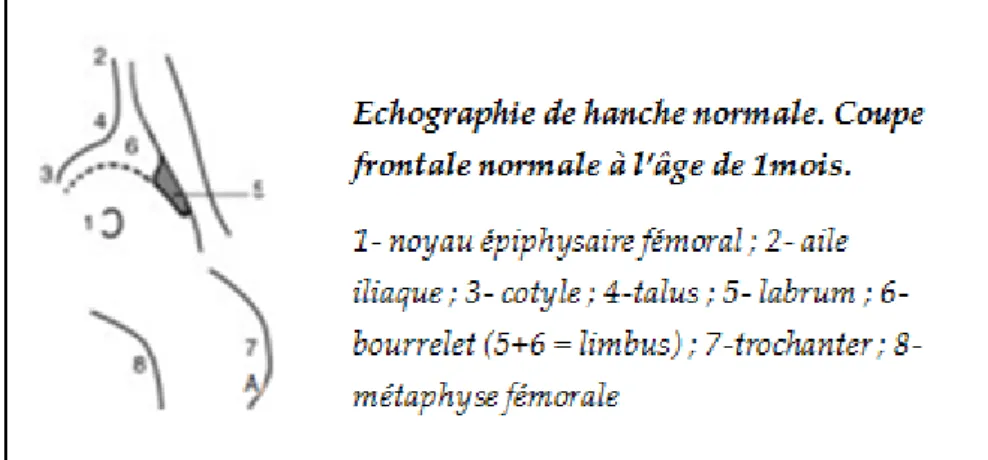 Figure 8 [18]: Echographie de hanche normale