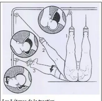 Figure 13 (7) : Les étapes de la traction 