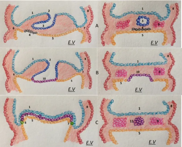 Figure 8 : Formation de la notochorde à partir de la plaque préchordale   et du processus notochordal (18 ème  et 19 ème  jour,  