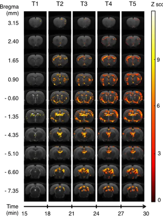 Figure 4.  Areas of significant activation following i.p. injection of F13714. Data are processed in successive  3-min blocks from onset of injection (T1) to the end of acquisition (T5)