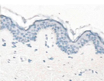 Fig. 4. Immunoréactivité continue pour la chaîne  α 1 du collagène IV au niveau des membranes basales dermo-épidermiques et  vascu-laires