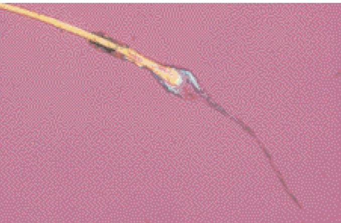 Fig. 2 : Aspects microscopiques de stades normaux du cycle pilaire au trichogramme. 